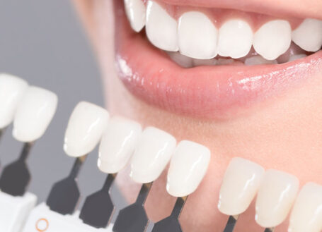 Enjoy a gorgeous smile – that won’t break the bank