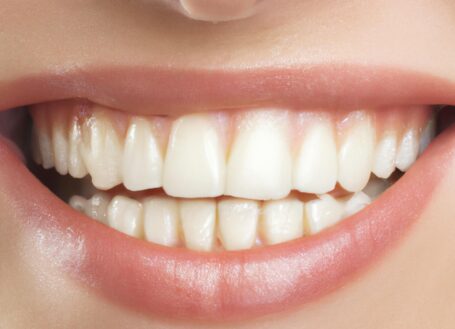 Are you looking for a whiter smile?
